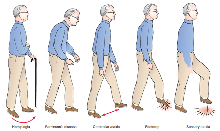 The Gait System How Gait Recognition Works And Physiotherapy 2022
