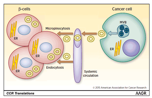 pancreas cancer exosome