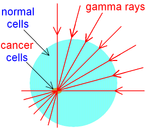 gamma rays radiation cells radiotherapy waves cancer physics ray treatment used therapy kill treat science normal wave electromagnetic does daily