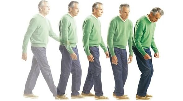 Enfermedad De Parkinson Y Corea De Huntington Patologias Que Afectan Al Snc Steemkr