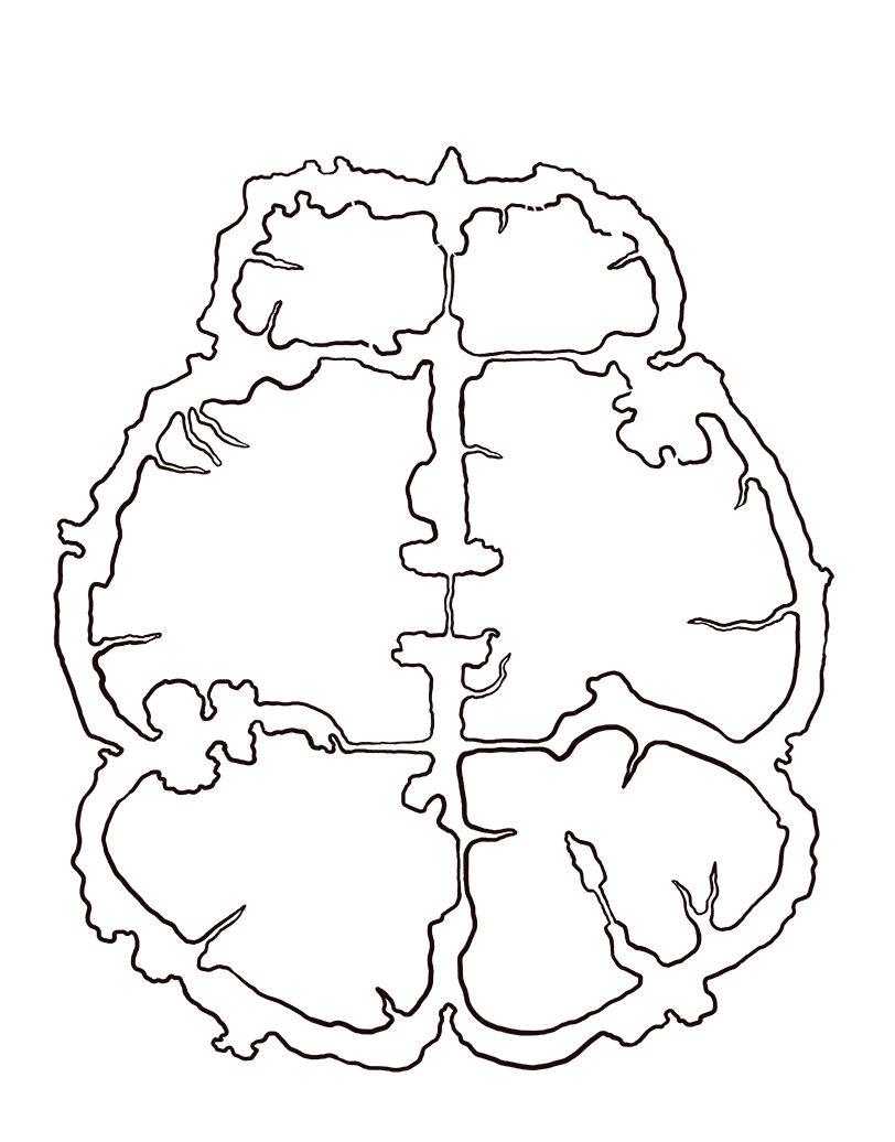 Dangerous adventure inside a GIANT brain! - fantasy lore and illustration -  step by step — Steemit