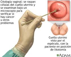 Vph como se cura