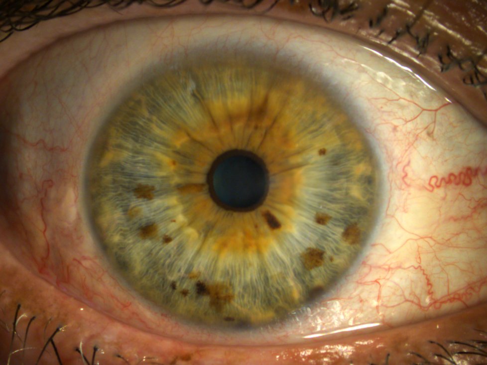 Human Eye Iris