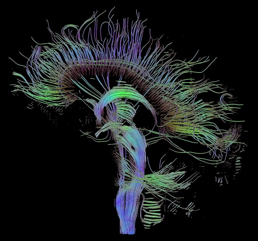 DTI-sagittal-fibers.jpg