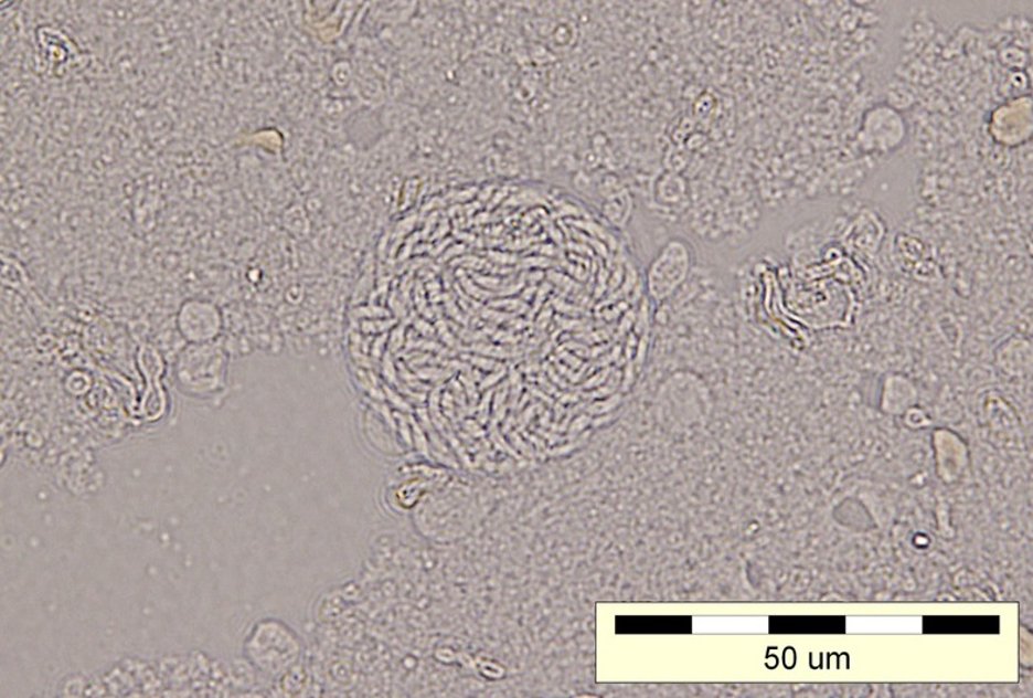 toxoplasmosis cyst in mouse brain 4.0 Parasite journal.jpg