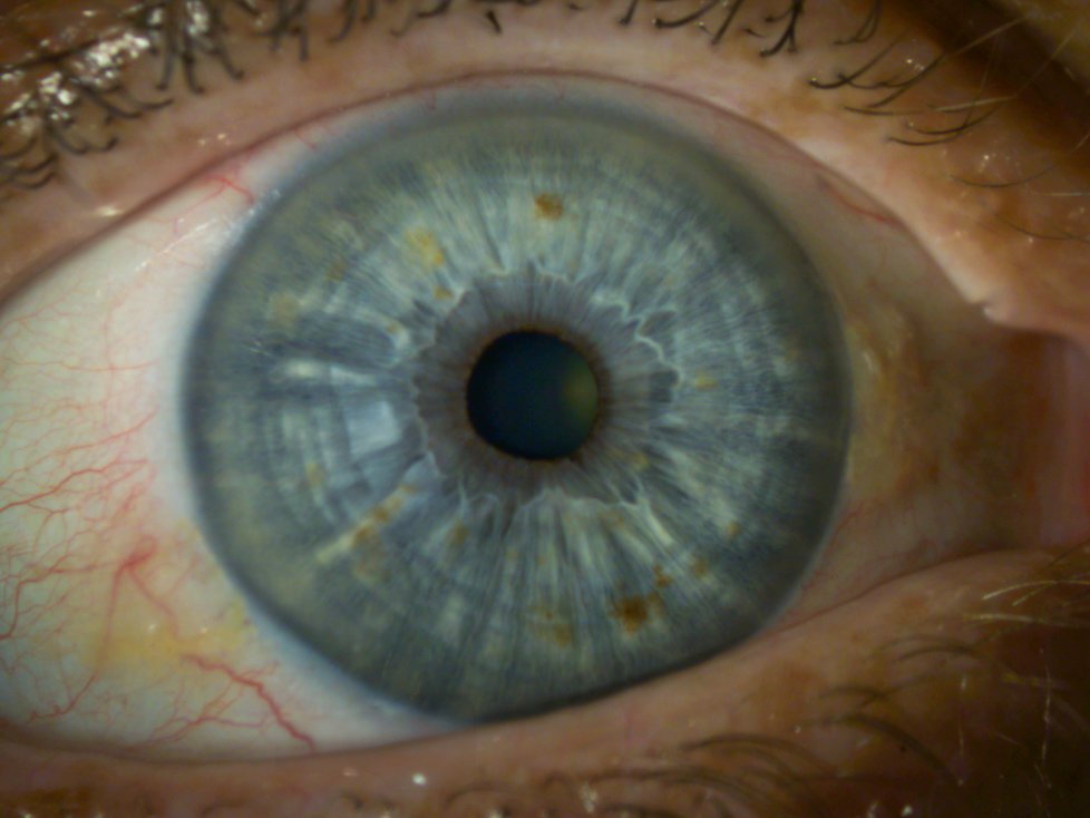 Human Eye Iris