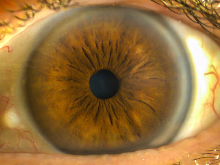 Human Eye Iris