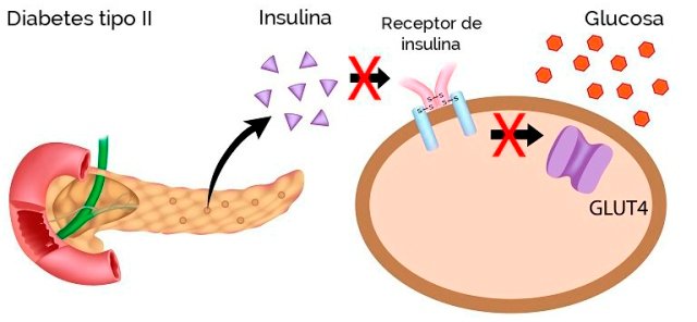DIABETES TIPO 2.jpg