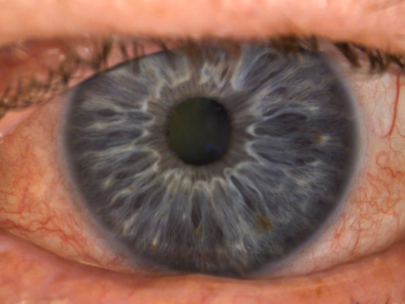 Human Eye Iris