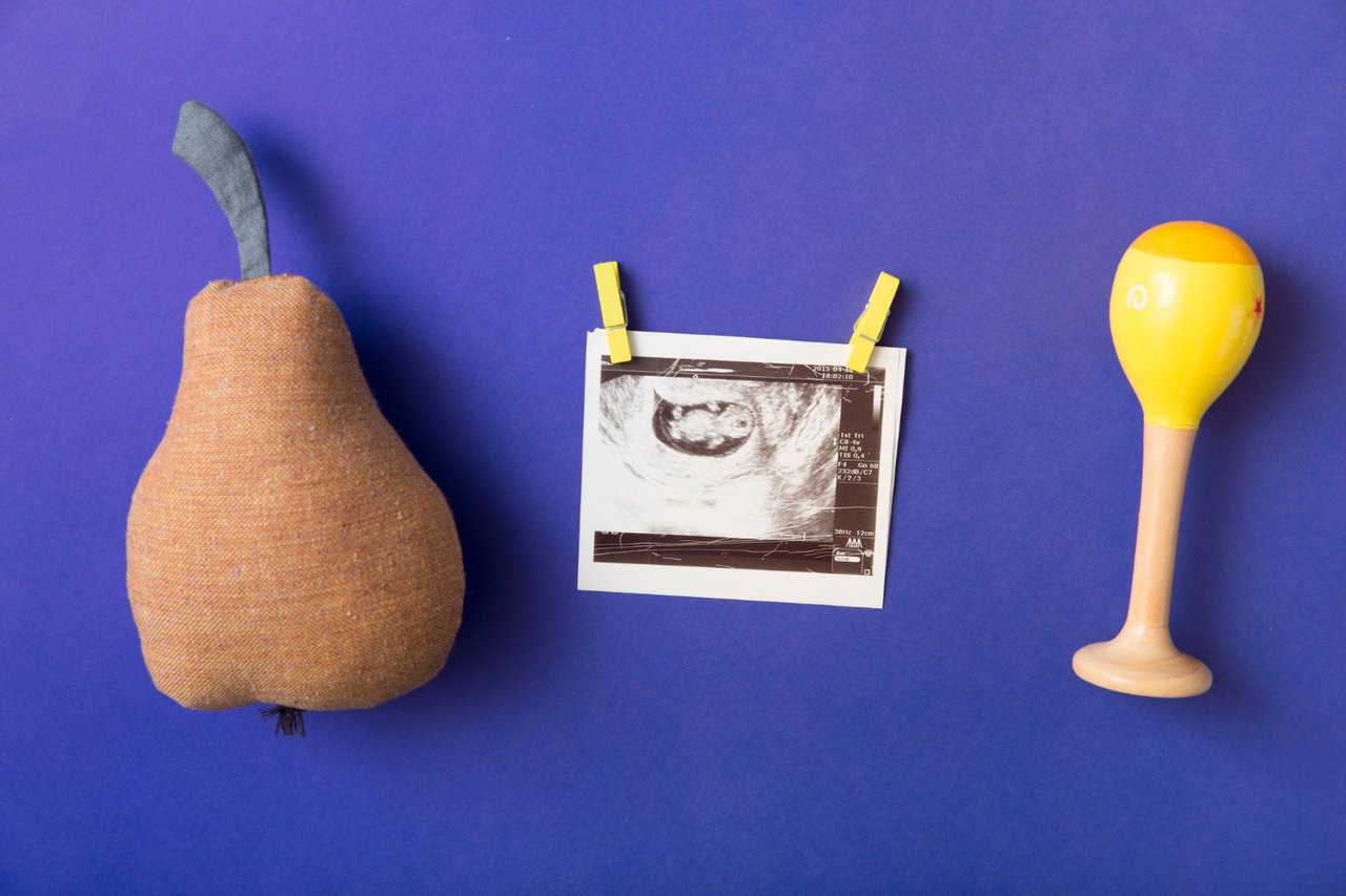 stuffed-pear-fruit-rattle-clothespin-with-ultrasound-picture-blue-colored-background.jpg