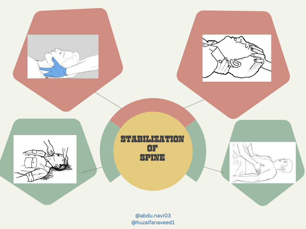 STABILIZATION OF SPINE.png