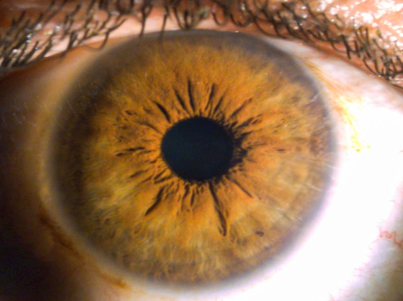 Human Eye Iris