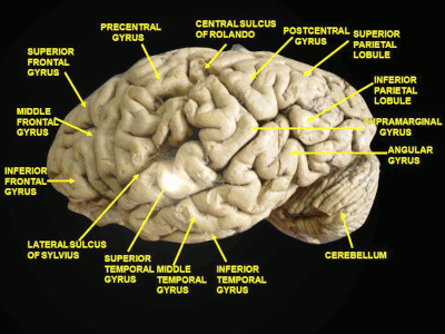 parietal and temporal gyrus gif.gif