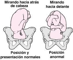 GYN_position_presentation_fetus_a_es.gif