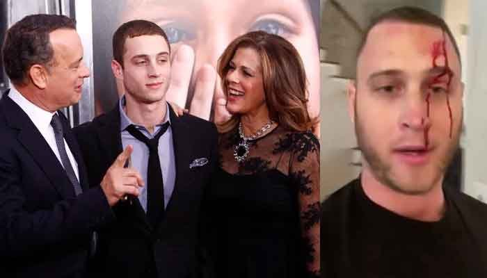 Tom Hanks' son Chet hurt in knife attack, accuses his girlfriend in disturbing video.jpg