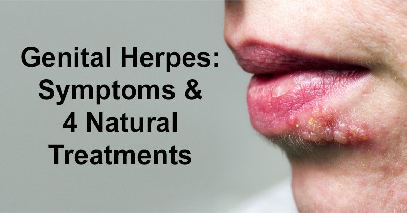 herpes tongue symptoms