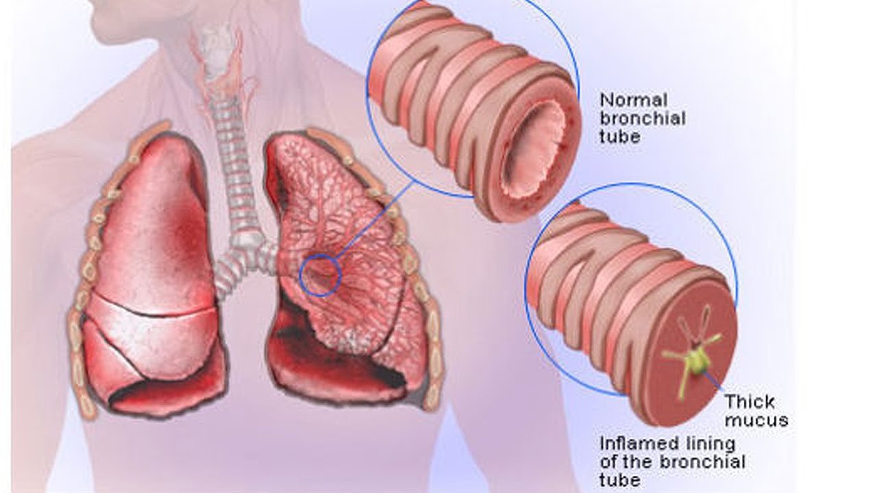 Phlegm/mucus color shows the health condition ! — Steemit
