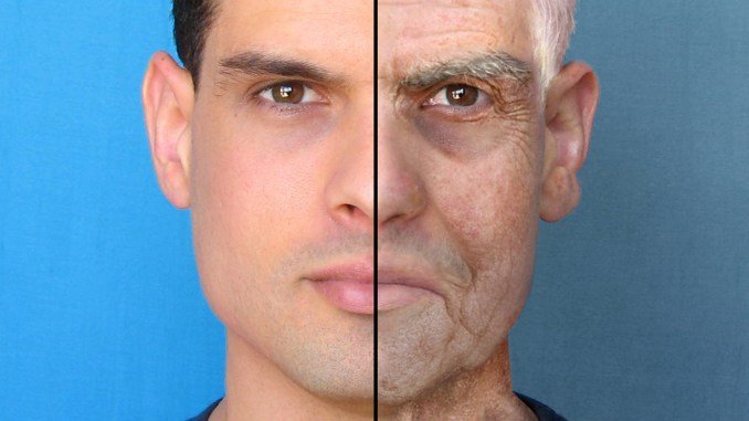 Prevention of skin wrinkles