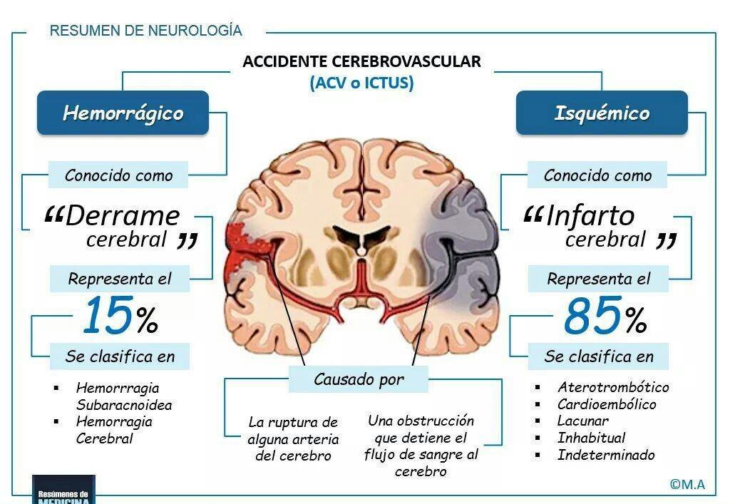 EVC ISQUEMICO PDF