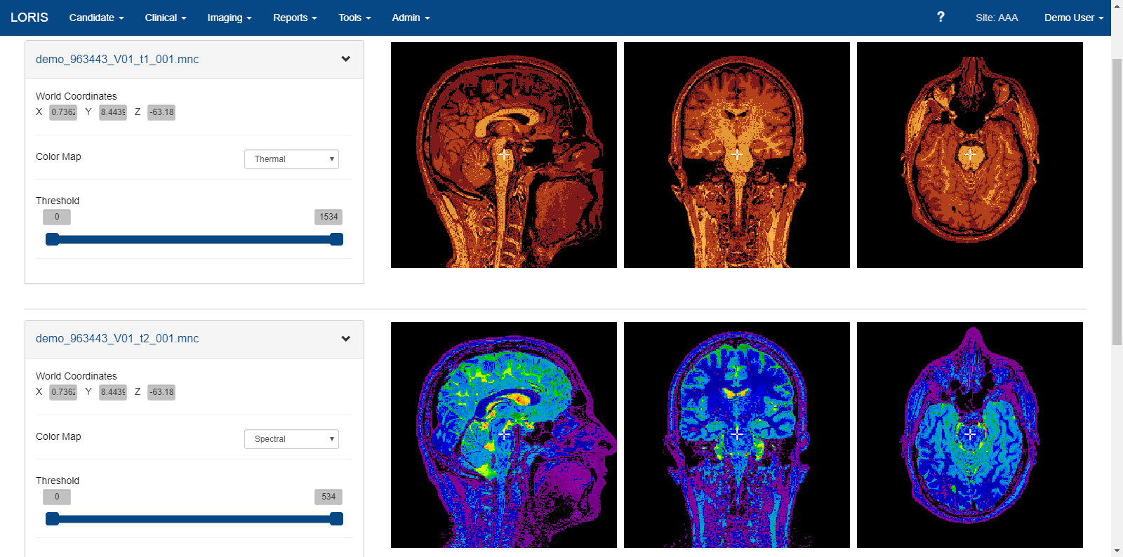 loris-mri-scans.png