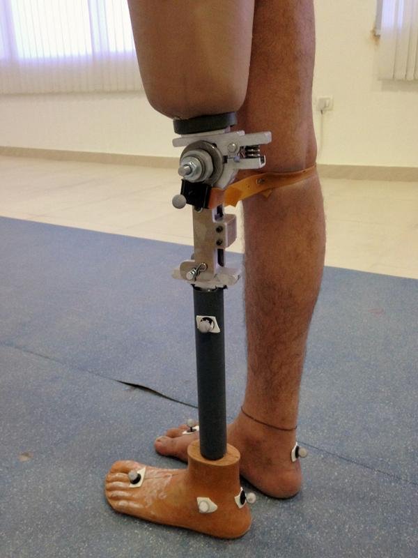 Near-natural Prosthetic limb: a new approach allows amputees feel ...