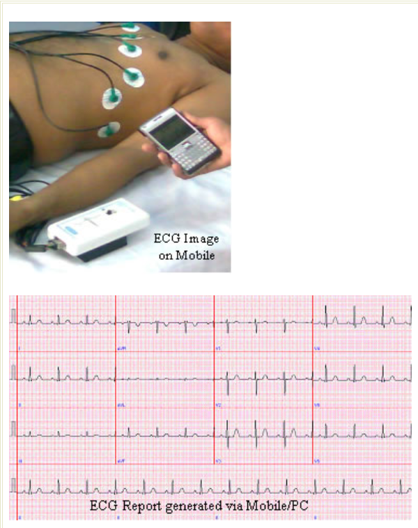 Tele ECG.png