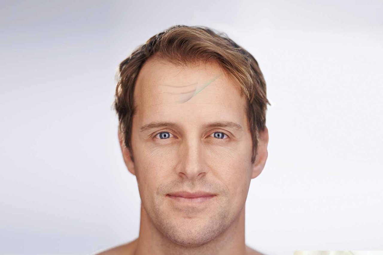 H-CHIRURGIE-MORPHOLOGIQUE-DE-LA-FACE-b.jpg