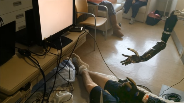 2019-03-03 21_30_56-Mind-Controlled Prosthetic Arm Moves Individual ‘Fingers’ - 02_15_2016 - Brave.png