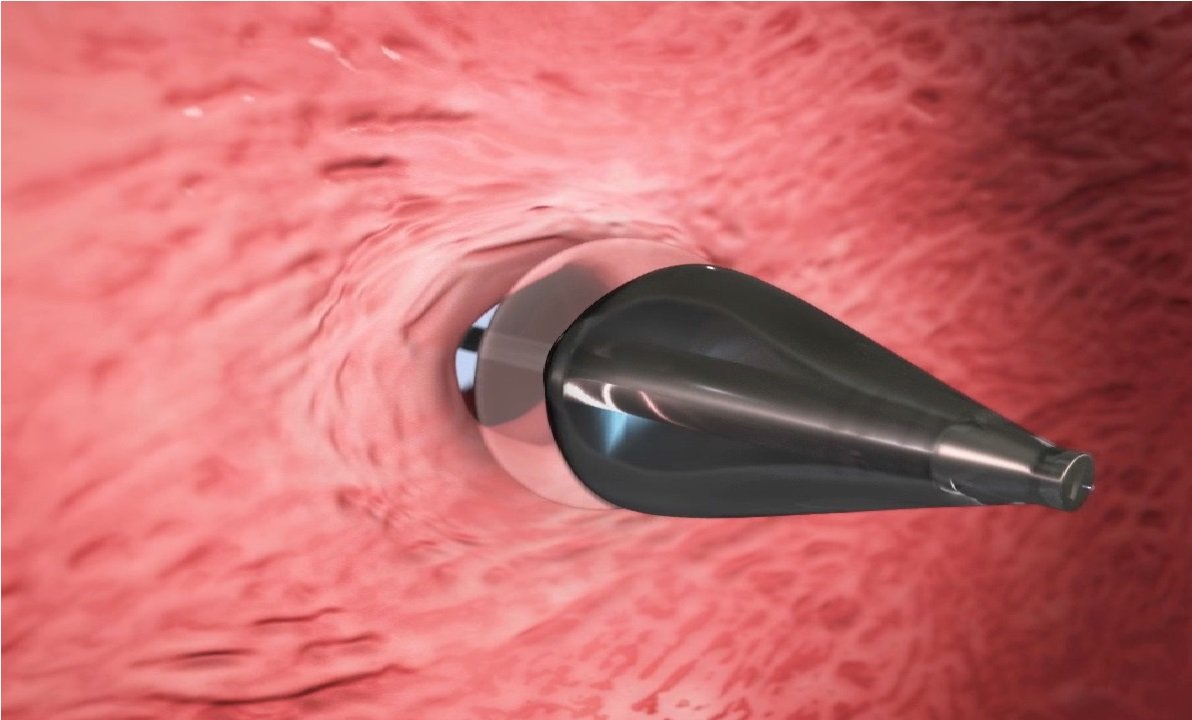 uvlightenabl.jpg