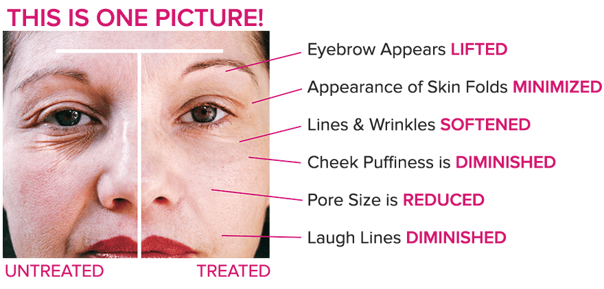 DermaWand PRO 3.png