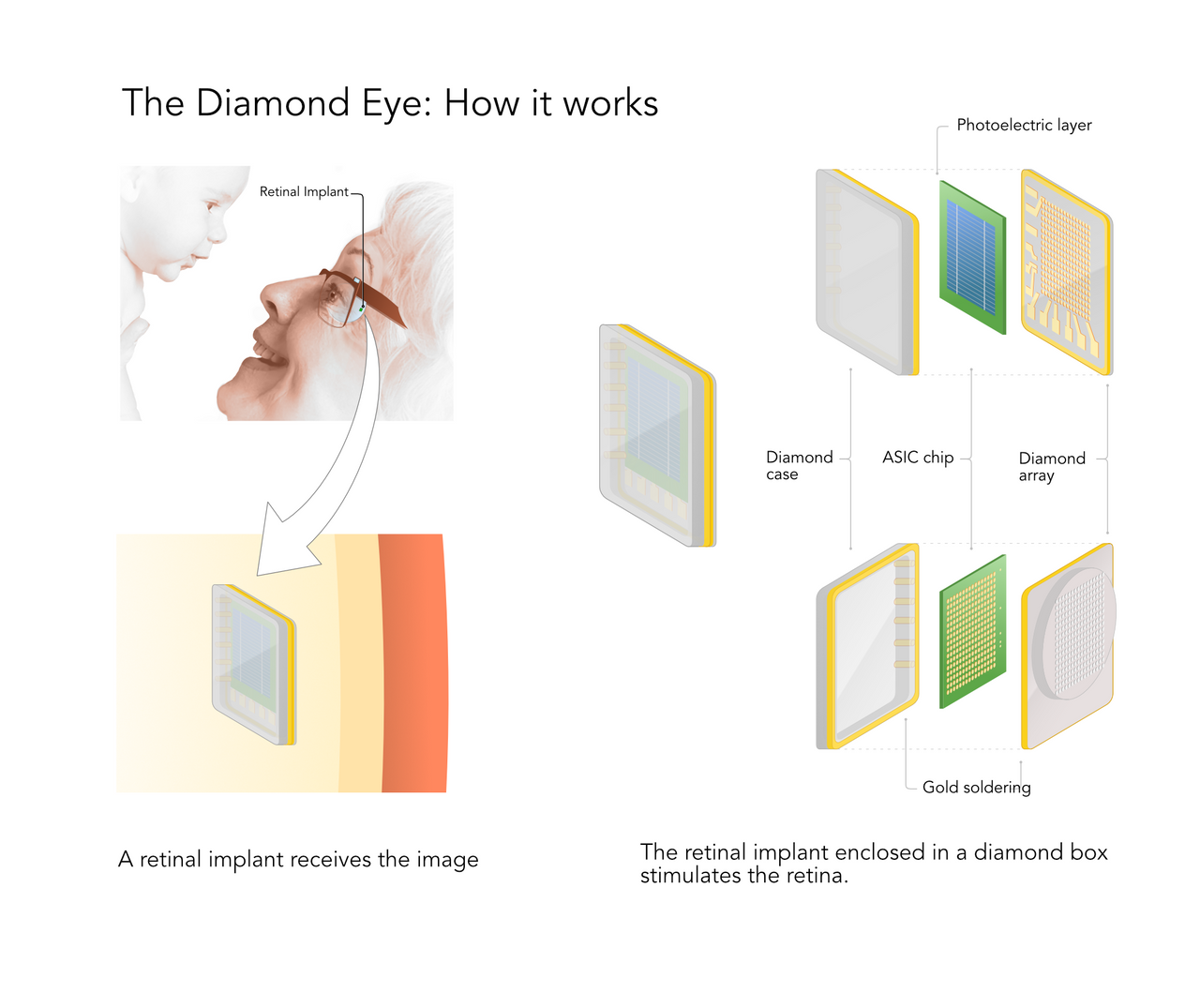 Diamond-Eye-How-It-Works.png