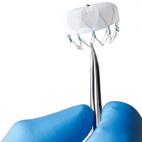 WATCHMAN_physicianHand.image.460.0.jpg