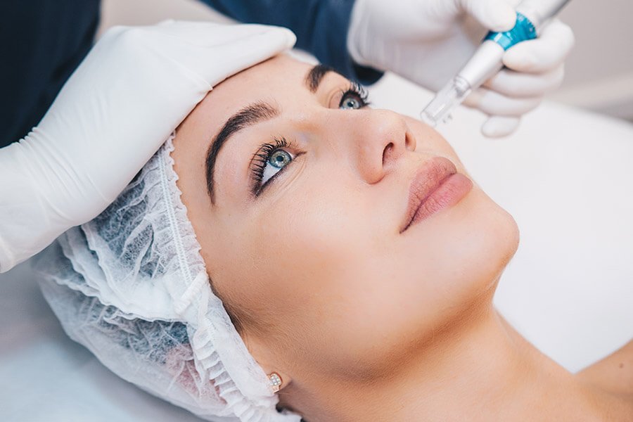 skin-prx-needling-3-1.jpg