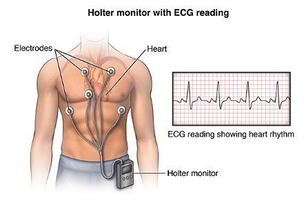 holter.jpg