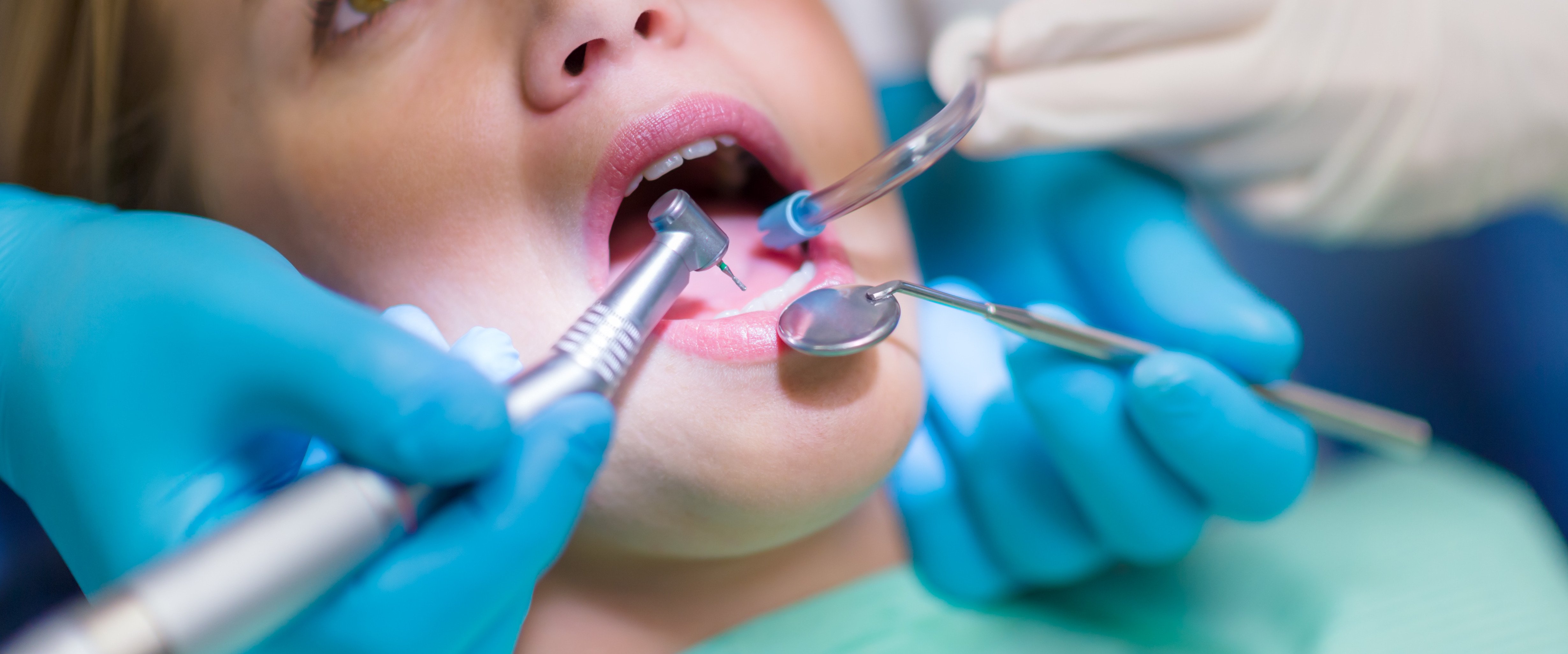 What You Need to Know About Dental Malpractice — Steemit