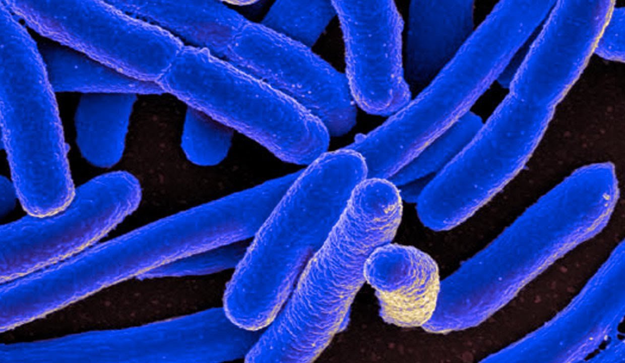 superbug E. coli.jpg