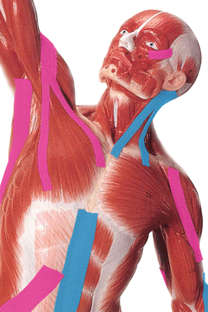 Kinesio.gif