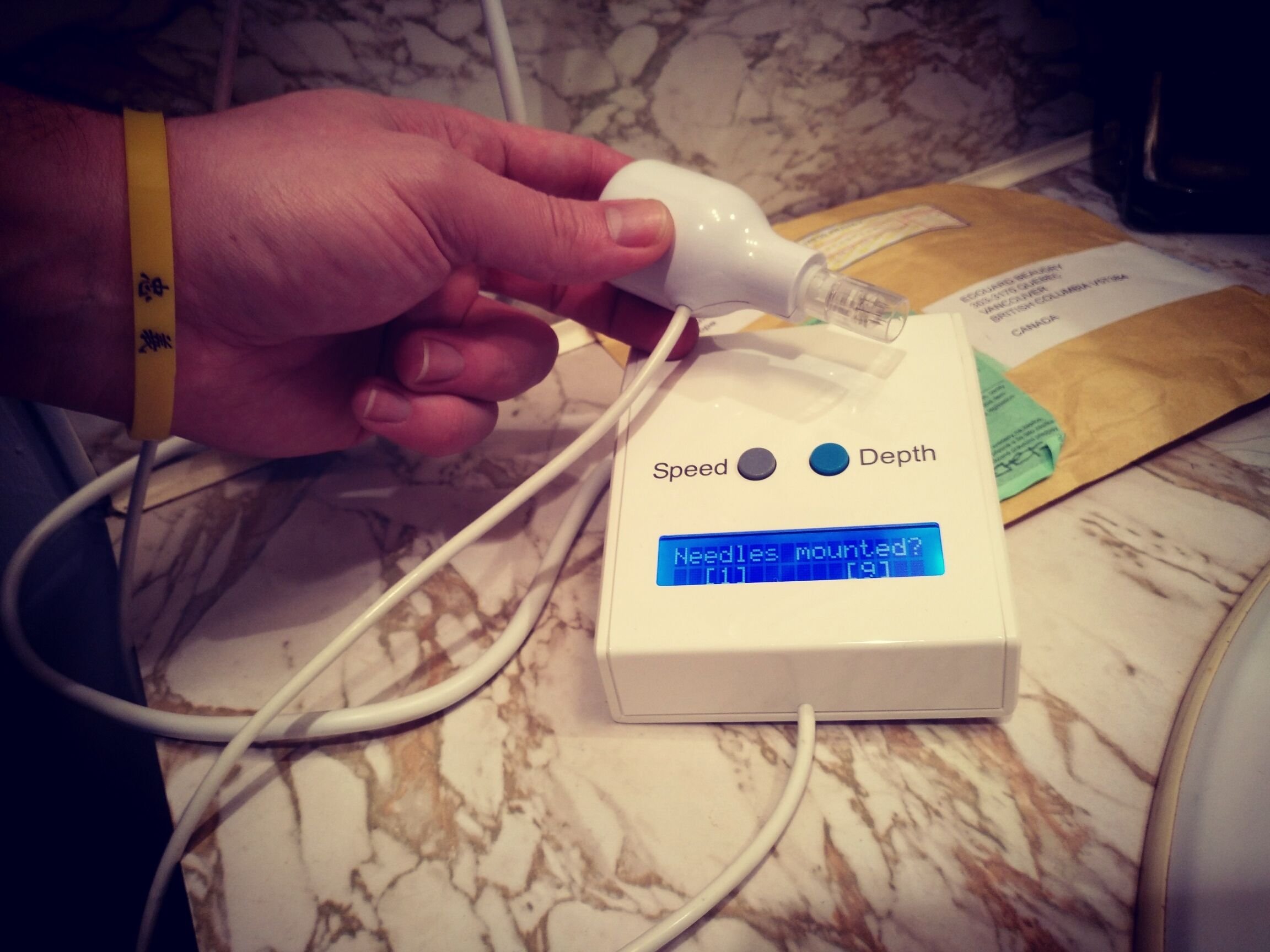 Microneedling, Extremely Effective but not for the Faint 