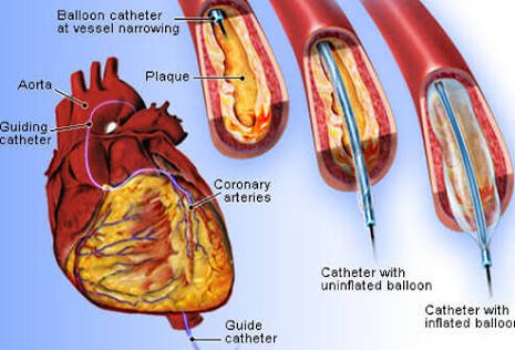 Why meat is, required for the 99% of development in the human system ...