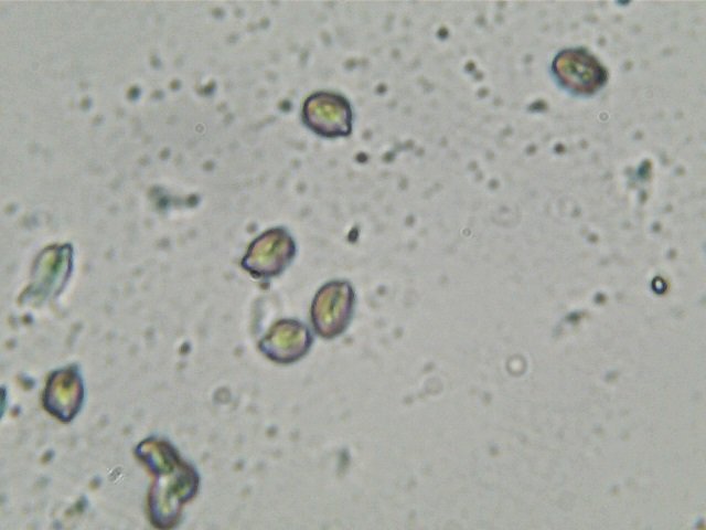 spores 40 over.65.jpg