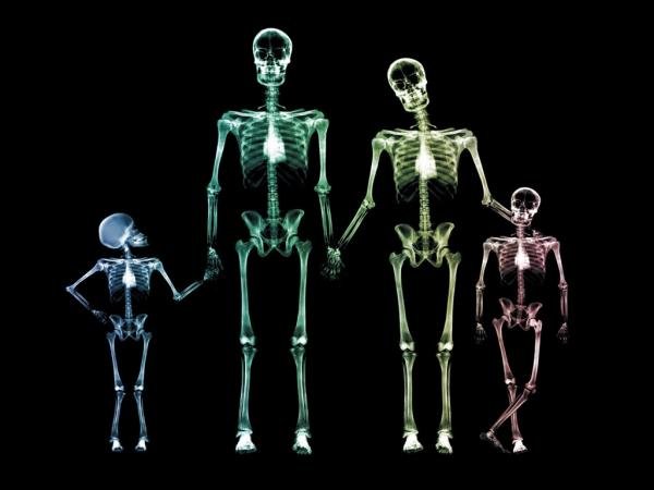 the xray family.jpg