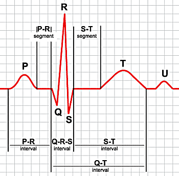 qrs.gif