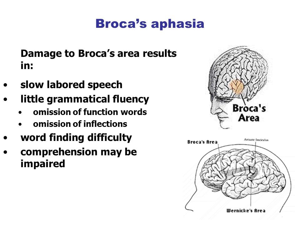 APHASIA, WHAT WE NEED TO KNOW ABOUT THIS DISORDER!!!