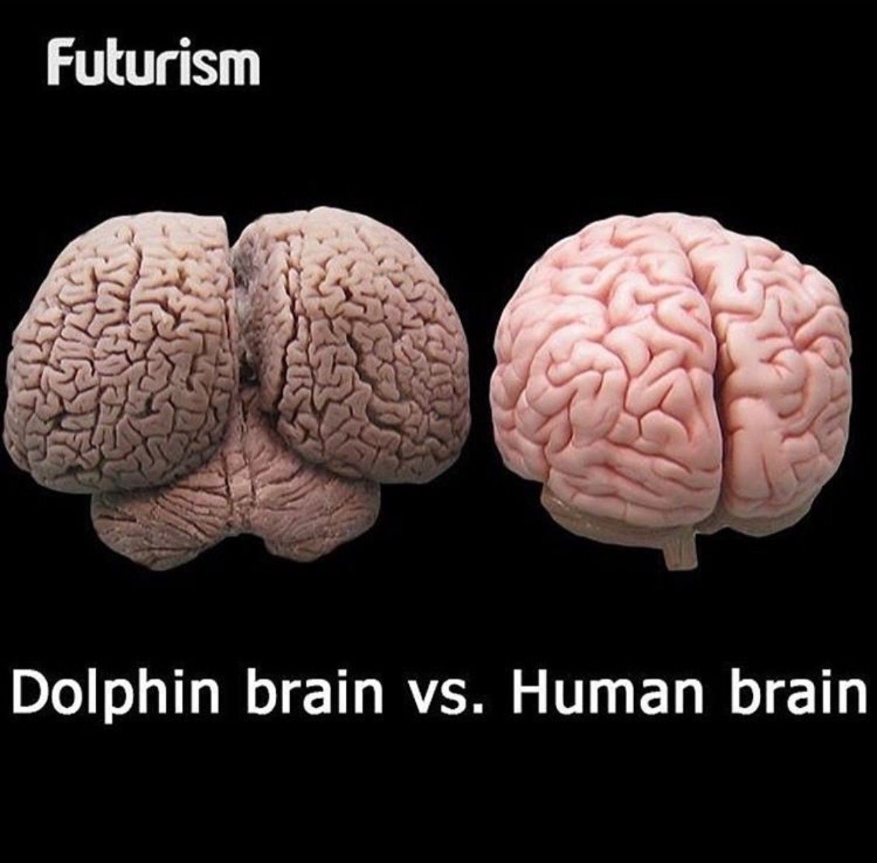 Dolphin Brain vs Human Brain — Steemkr
