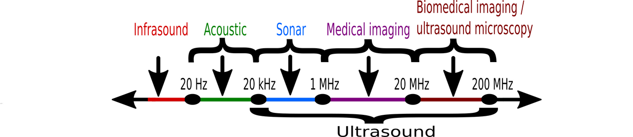 ultrasoundRange.png