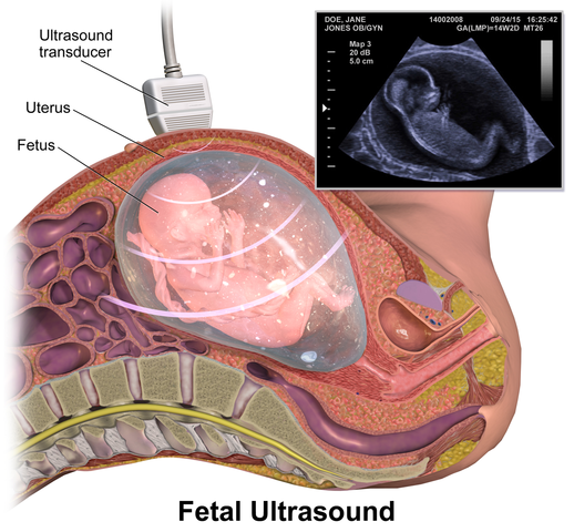 Fetal_Ultrasound.png