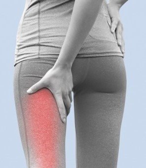 sciatica