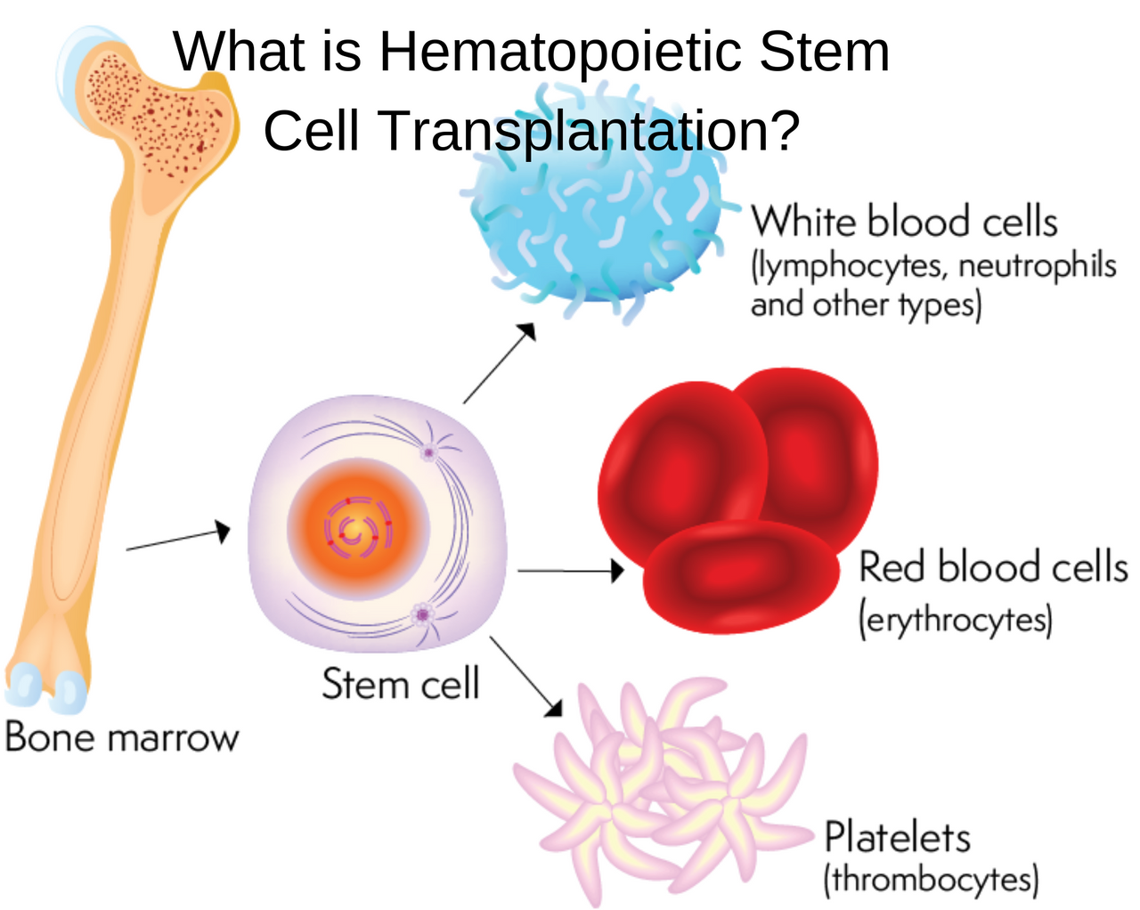 What Is Hematopoietic Stem Cell Transplantation Steempeak