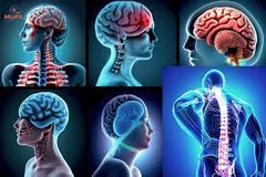 Neuro