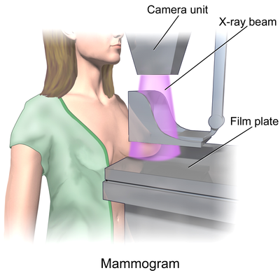 Mammogram.png